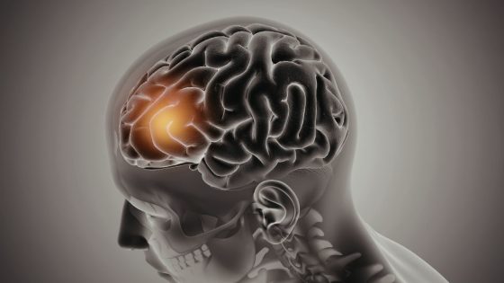 neurodiverzitás